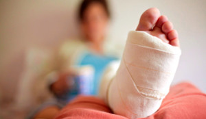 broken-leg_342x198_108880219